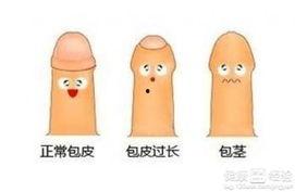 包皮切割视频,专业视角下的直观解读