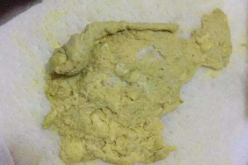 大便发白图片,原因与应对策略